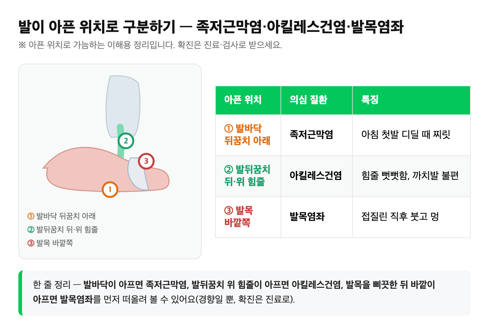 발바닥은 족저근막염, 발뒤꿈치 위 힘줄은 아킬레스건염, 발목 바깥쪽은 발목염좌로 통증 부위별 구분을 정리한 비교표