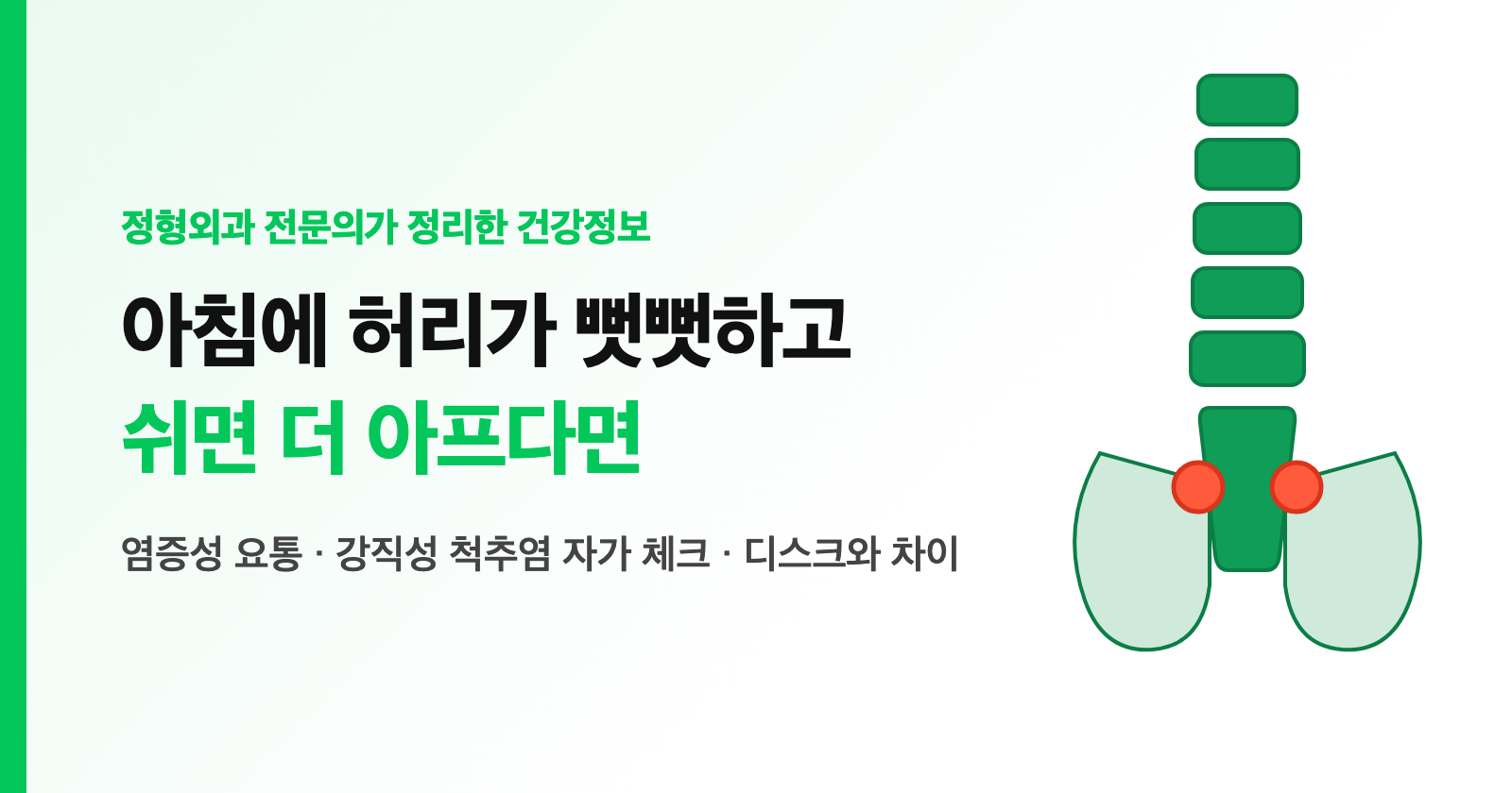 아침에 허리가 뻣뻣하고 쉬면 더 아프다면 — 단순 요통이 아닐 수 있습니다 (염증성 요통·강직성 척추염 자가 체크)