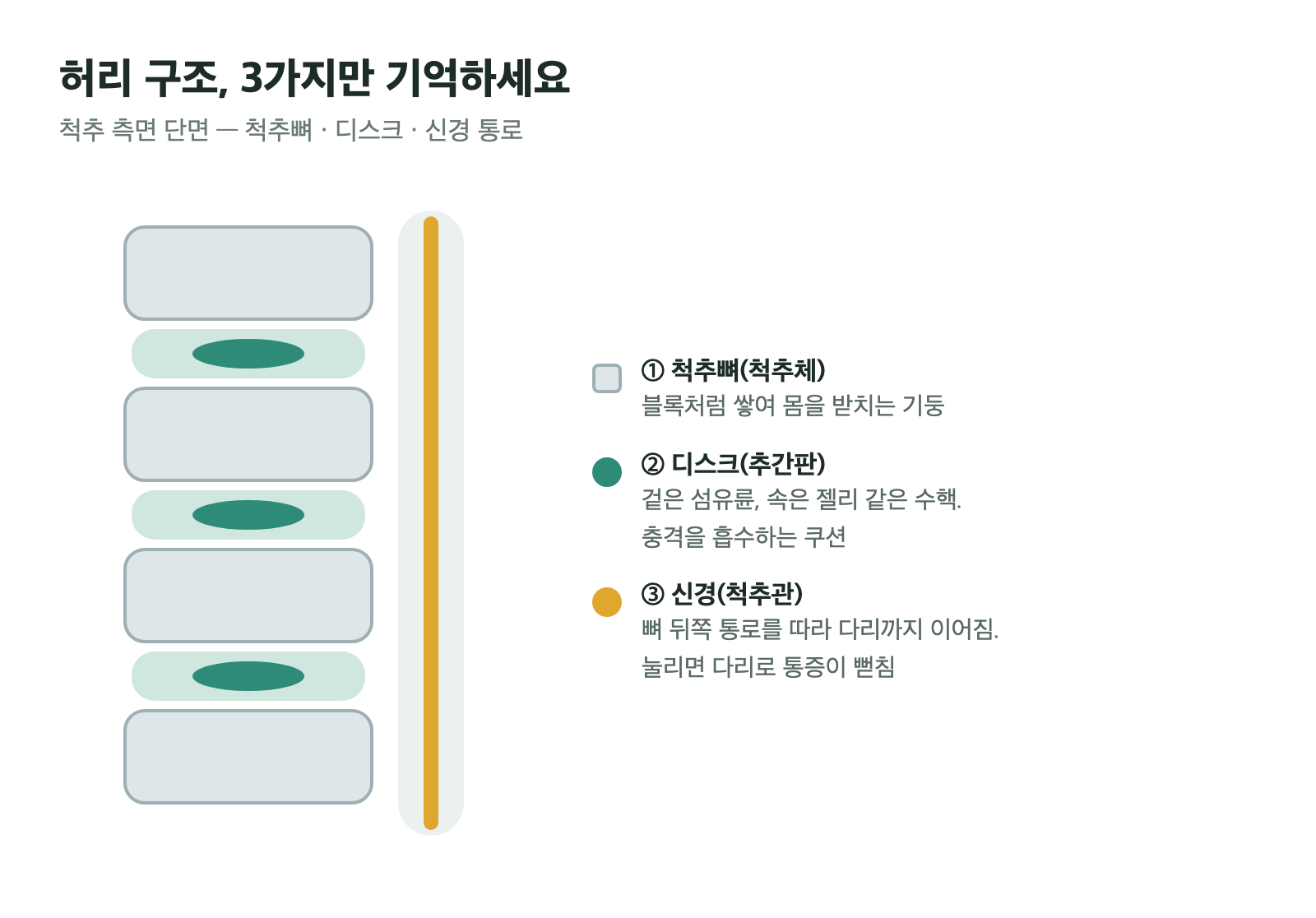 척추뼈(척추체)·디스크(섬유륜과 수핵)·신경 통로(척추관)를 표시한 척추 측면 단면 모식도