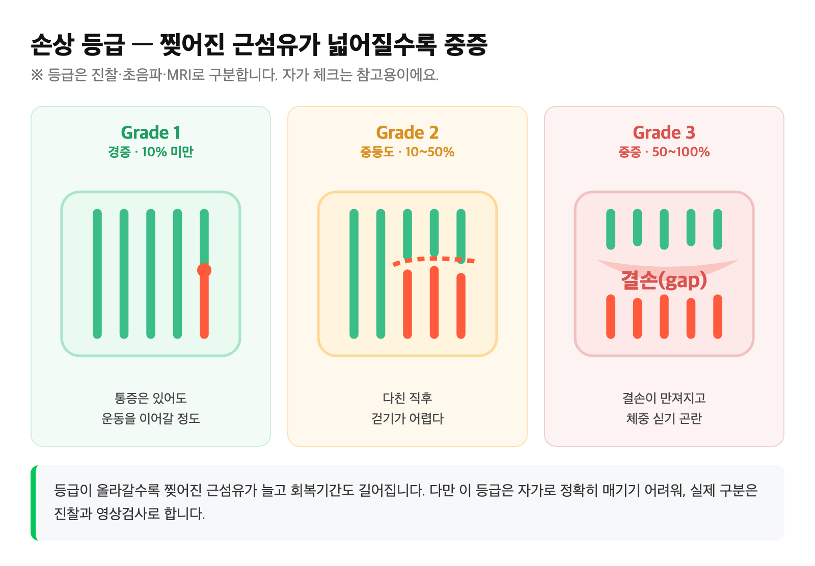 Grade 1·2·3 등급별로 찢어진 근섬유 손상 범위가 넓어지며 중증으로 진행하는 모습을 비교한 모식도