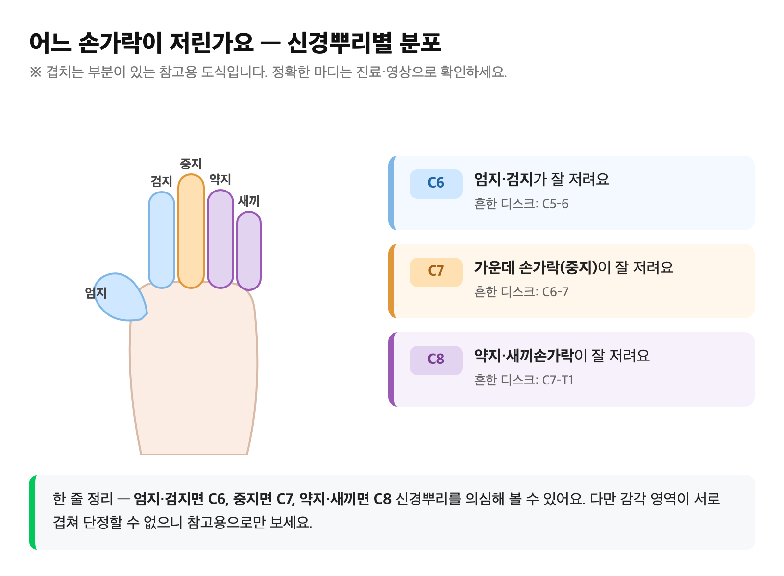 엄지·검지(C6), 중지(C7), 약지·새끼(C8)로 나뉘는 손가락별 저림 분포를 단순화한 손 그림
