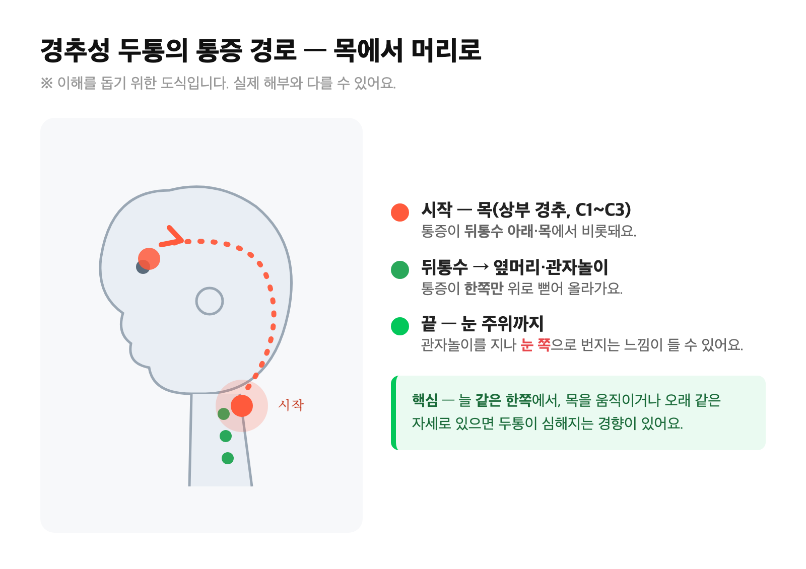 목(상부 경추)에서 시작해 뒤통수에서 옆머리·관자놀이를 지나 눈 주위로 한쪽만 뻗어 올라가는 경추성 두통의 통증 경로를 옆얼굴 위에 화살표로 표시한 일러스트