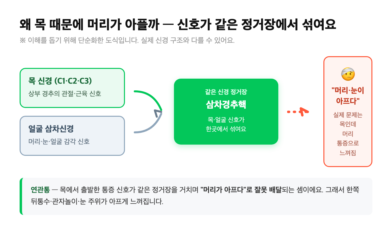 상부 경추(C1·C2·C3) 신경과 얼굴 삼차신경이 뇌의 같은 신경핵(삼차경추핵)으로 모여 목 신호가 머리 통증으로 잘못 배달되는 연관통 원리를 단순화한 도식