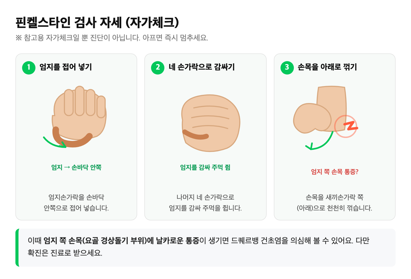 핀켈스타인 검사 자세 - 엄지를 손바닥에 넣고 주먹을 쥔 뒤 손목을 새끼손가락 쪽으로 꺾는 동작을 단순화한 그림