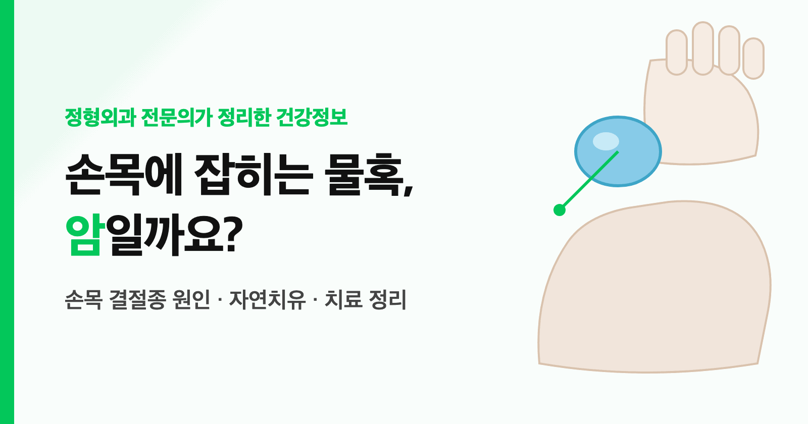 손목에 잡히는 물혹, 암일까요? 손목 결절종 원인·자연치유·치료 정리 (전문의 정리)