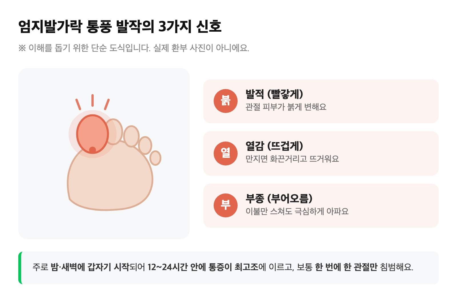 엄지발가락 통풍 발작의 발적·열감·부종을 단순화해 표현한 비식별 일러스트