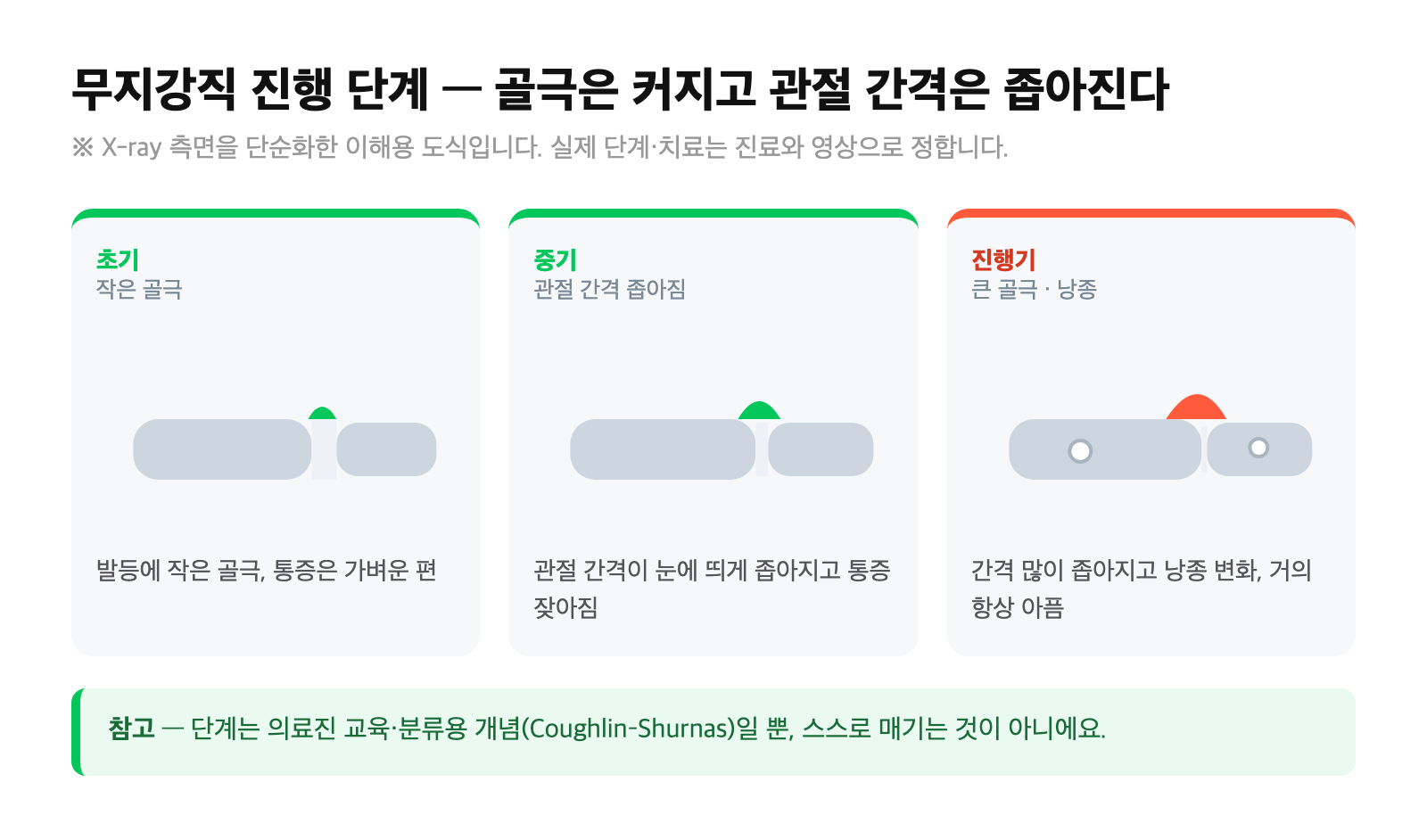 무지강직 진행 단계 도식 — 초기 작은 골극부터 진행기 큰 골극·좁아진 관절 간격까지