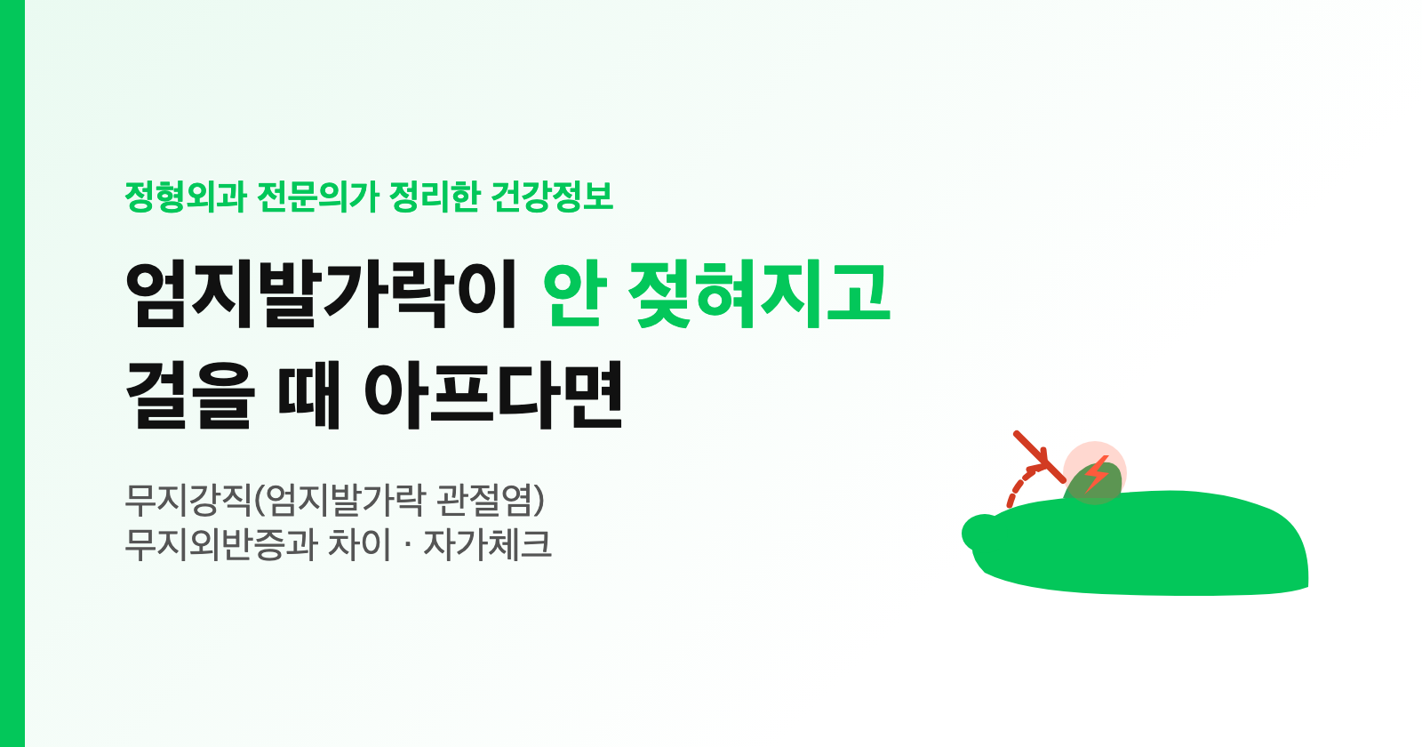 무지강직(엄지발가락 관절염): 안 젖혀지고 걸을 때 아프면? 무지외반증과 차이·자가체크·치료 (전문의 정리)