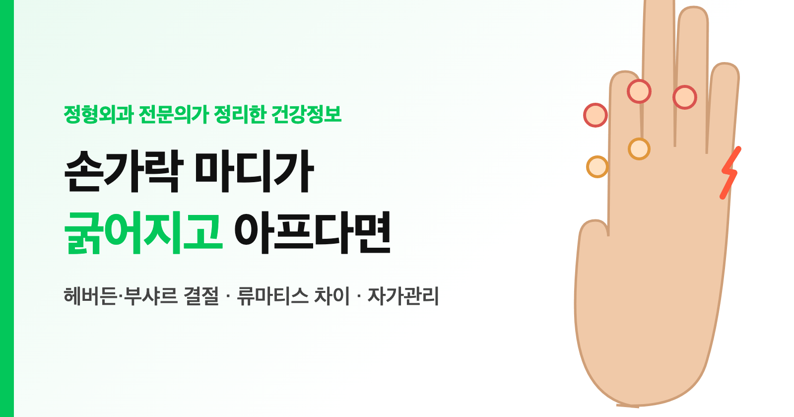 손가락 관절염 증상, 마디가 굵어지고 아파요 — 헤버든·부샤르 결절과 류마티스 차이 (전문의 정리)