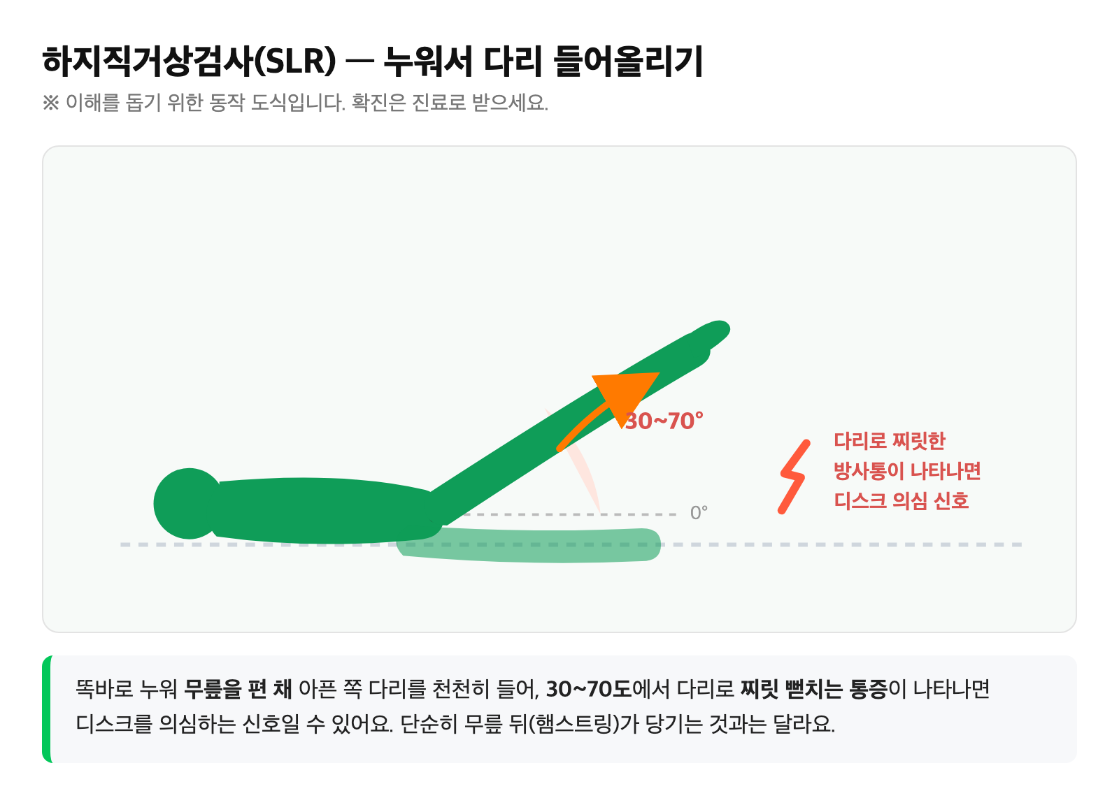 똑바로 누워 무릎을 편 채 다리를 들어올리는 하지직거상검사(SLR) 동작과 방사통이 나타나는 30~70도 구간을 표시한 도식