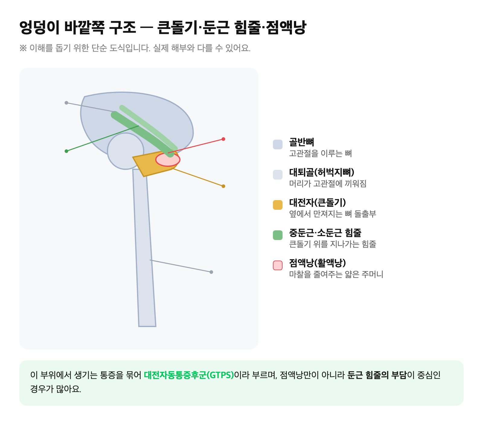 골반과 대전자(큰돌기), 그 위를 지나는 중둔근·소둔근 힘줄과 점액낭의 위치를 단순화한 이해용 도식