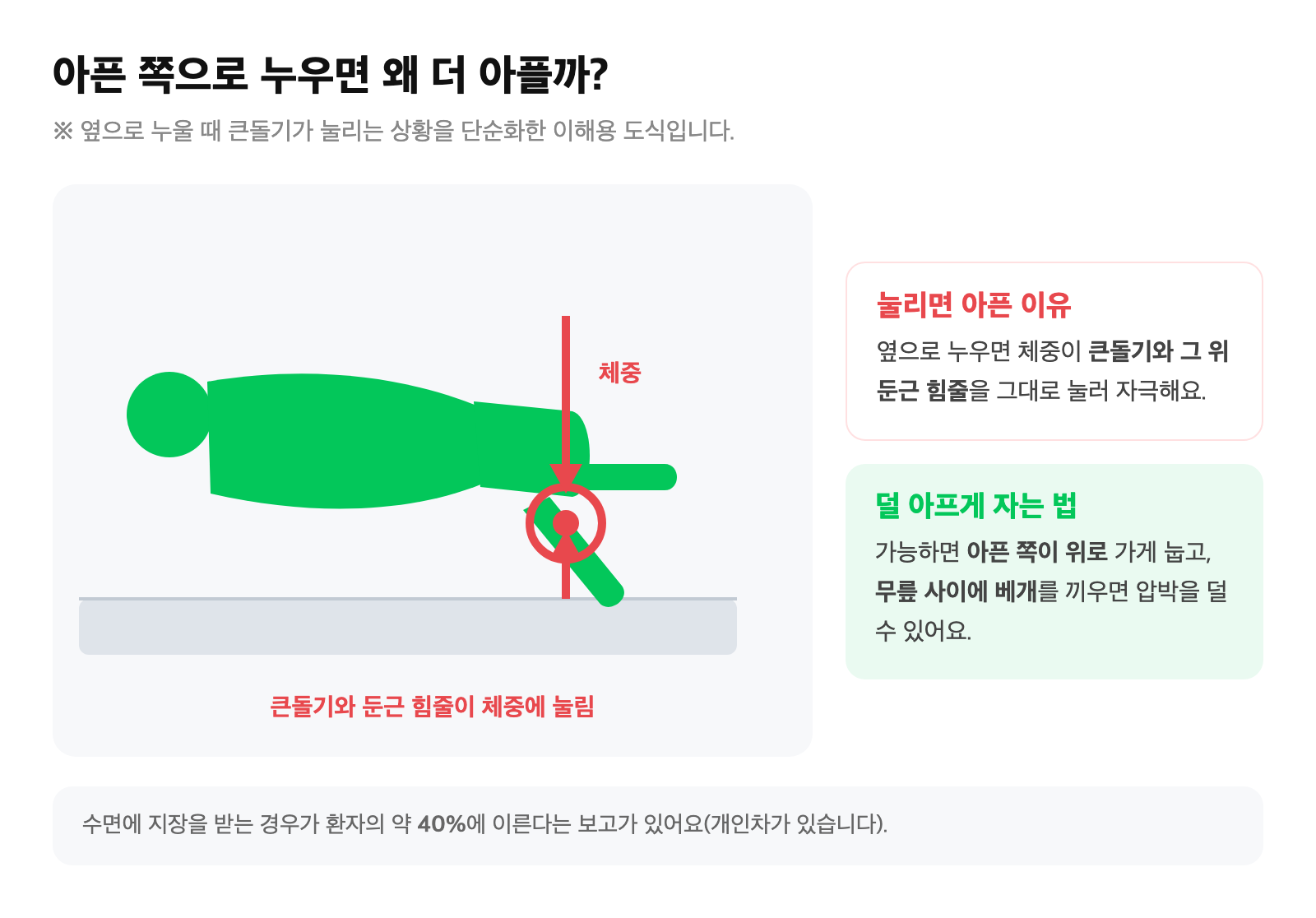 옆으로 누울 때 체중이 큰돌기와 둔근 힘줄을 눌러 통증이 생기는 모습을 단순화한 이해용 모식도