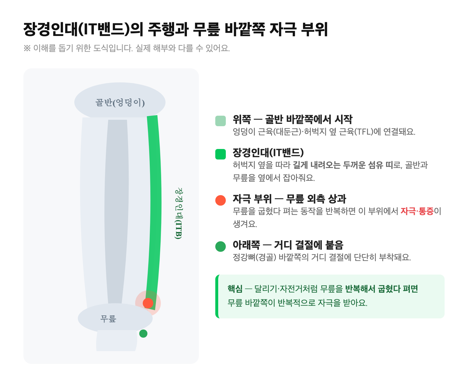 장경인대가 골반에서 무릎 바깥쪽(거디 결절)까지 허벅지 옆을 따라 내려오는 주행과, 무릎 바깥쪽 외측 상과 자극 부위를 표시한 도식
