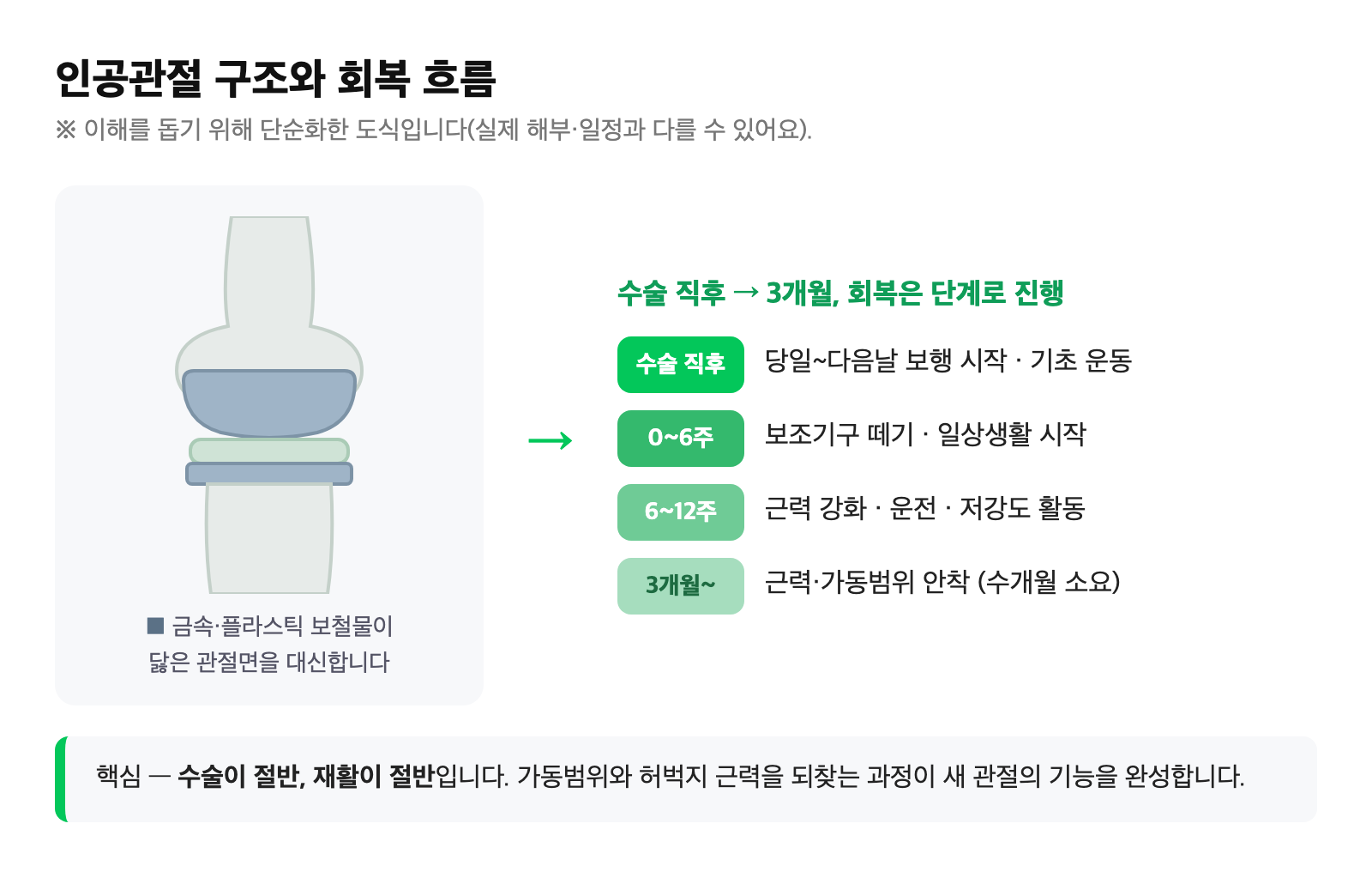 무릎 인공관절 금속·플라스틱 보철물 구조와 수술 직후부터 3개월까지 단계별 회복 흐름을 단순화한 도식