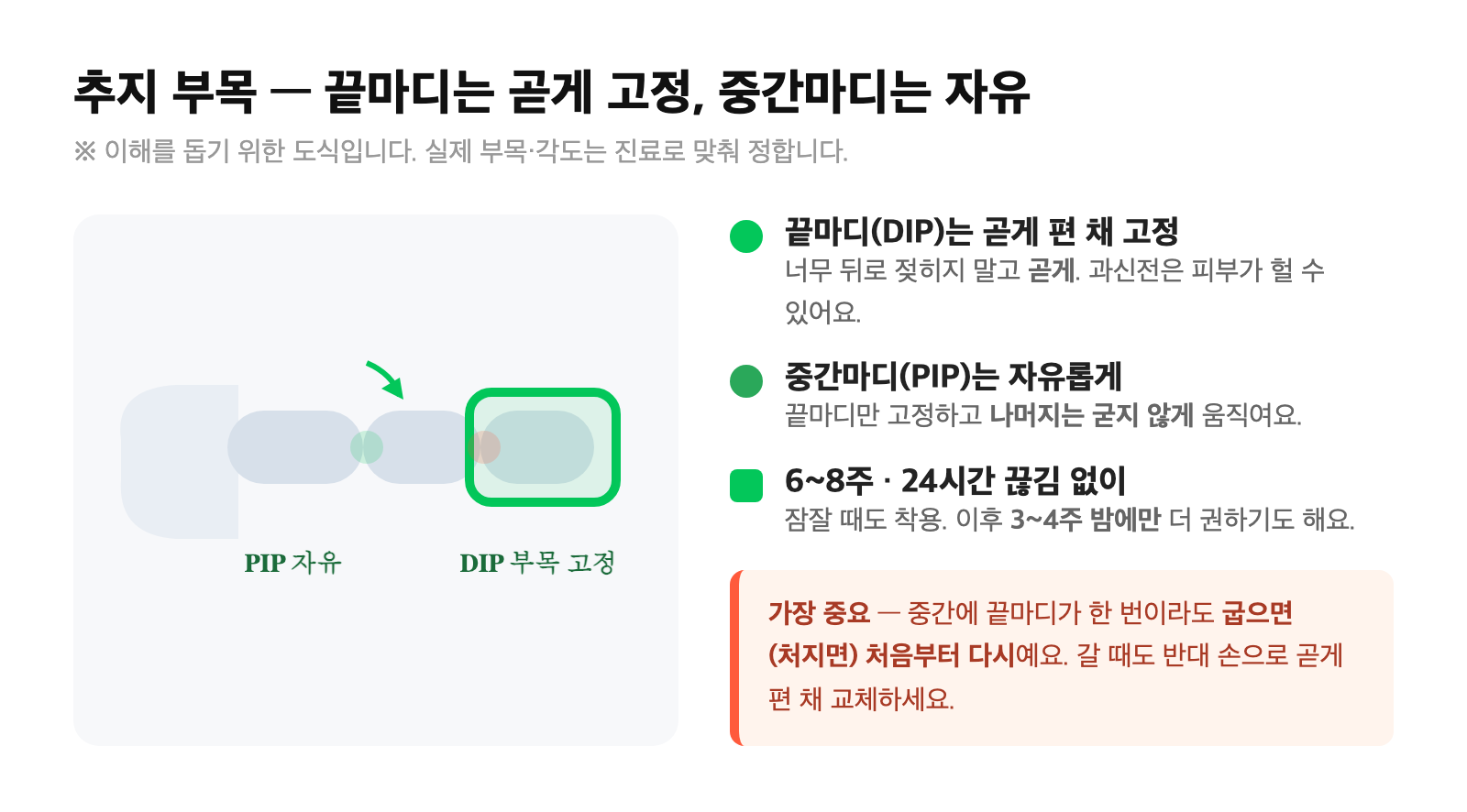 끝마디(DIP)는 곧게 편 채 부목으로 고정하고 중간마디(PIP)는 자유롭게 움직이도록 둔 추지 신전 부목 착용 도식