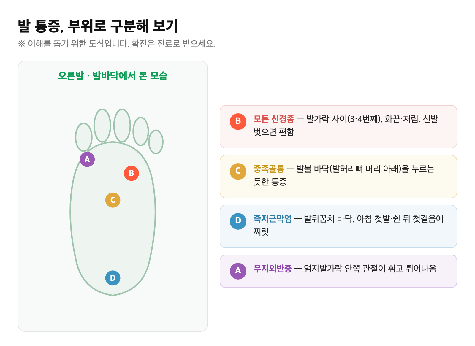 발 통증 부위별 비교 그림 — 뒤꿈치(족저근막염) vs 발볼 바닥(중족골통) vs 발가락 사이(모튼 신경종) vs 엄지관절(무지외반증) 위치 표시