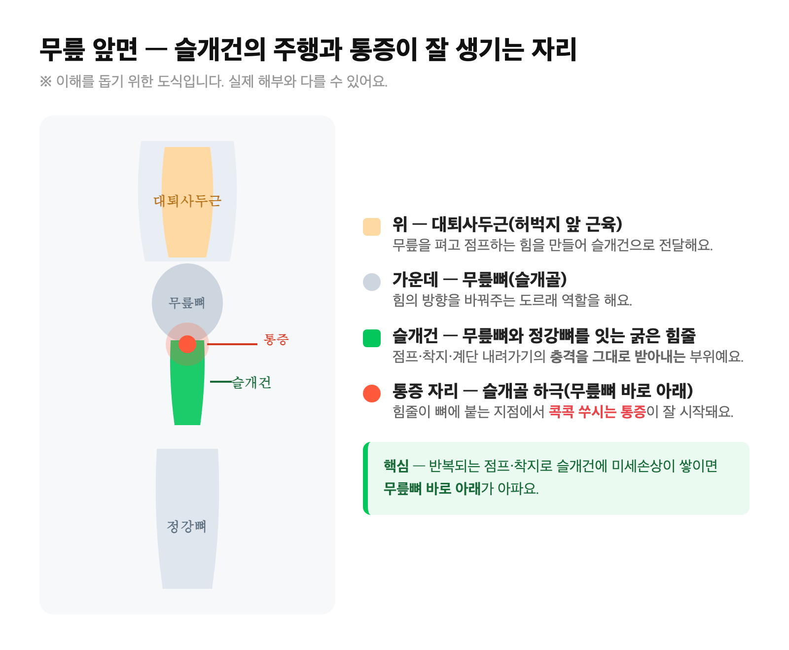 무릎 앞면 해부 도식 — 대퇴사두근에서 슬개골을 거쳐 정강뼈로 이어지는 슬개건의 주행과 무릎뼈 바로 아래 통증 부위 표시