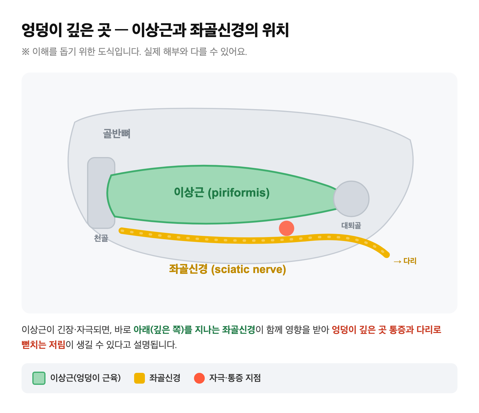 엉덩이 깊은 곳에서 이상근과 그 아래를 지나는 좌골신경의 위치를 보여주는 도식