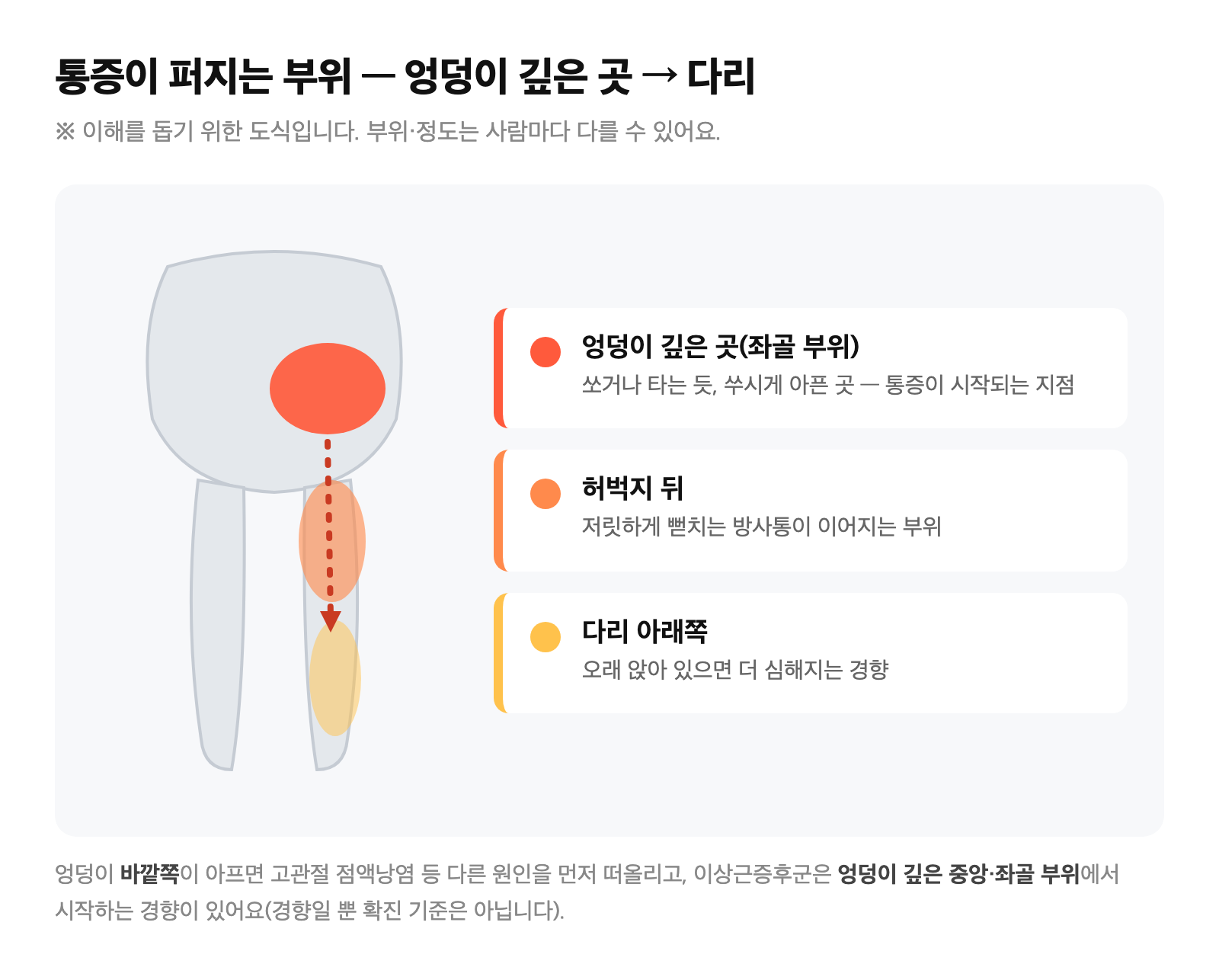 엉덩이 깊은 곳에서 시작해 허벅지 뒤·다리로 통증이 퍼지는 부위를 표시한 모식도