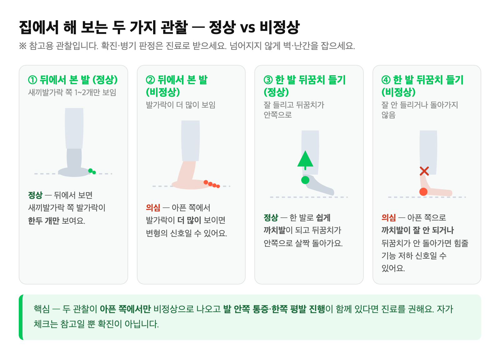 집에서 해 보는 자가 관찰 일러스트 — 뒤에서 본 발 모양(too many toes sign)과 한 발 뒤꿈치 들기 검사의 정상 vs 비정상 비교