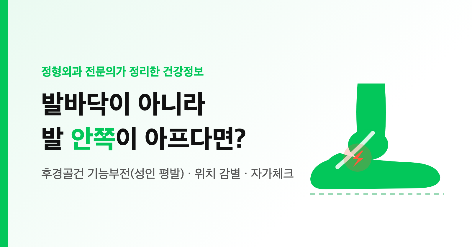 나이 들며 한쪽 발만 평발이 되고 발 안쪽이 아프다면? 후경골건 기능부전(성인 평발) 증상·자가체크·족저근막염과 차이 (정형외과 정리)