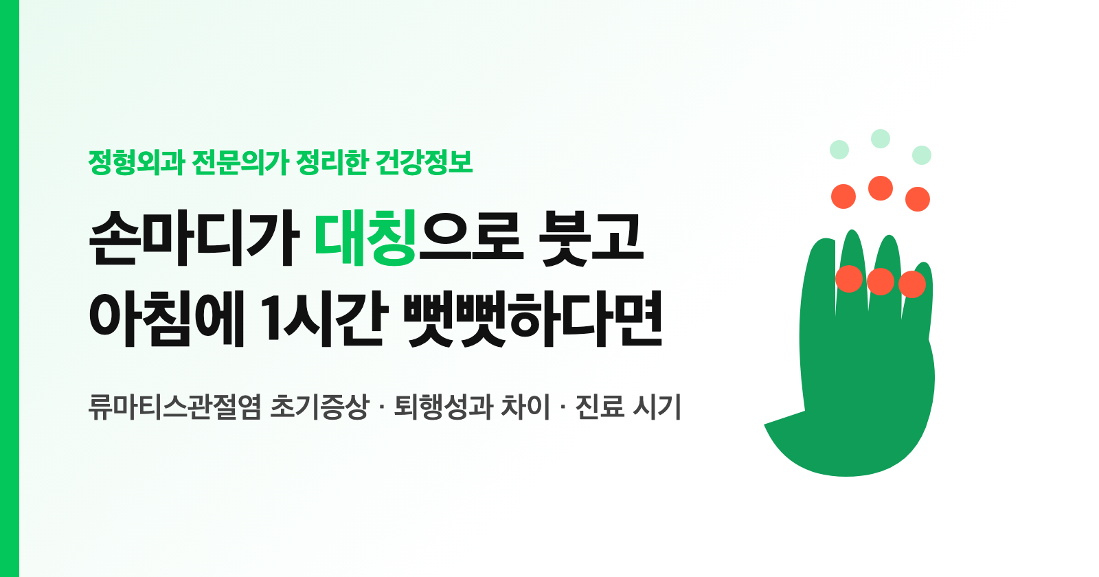 손가락이 양쪽 대칭으로 붓고 아침에 1시간 뻣뻣하다면? 류마티스관절염 초기증상·퇴행성과 차이·진료 시기 (전문의 정리)