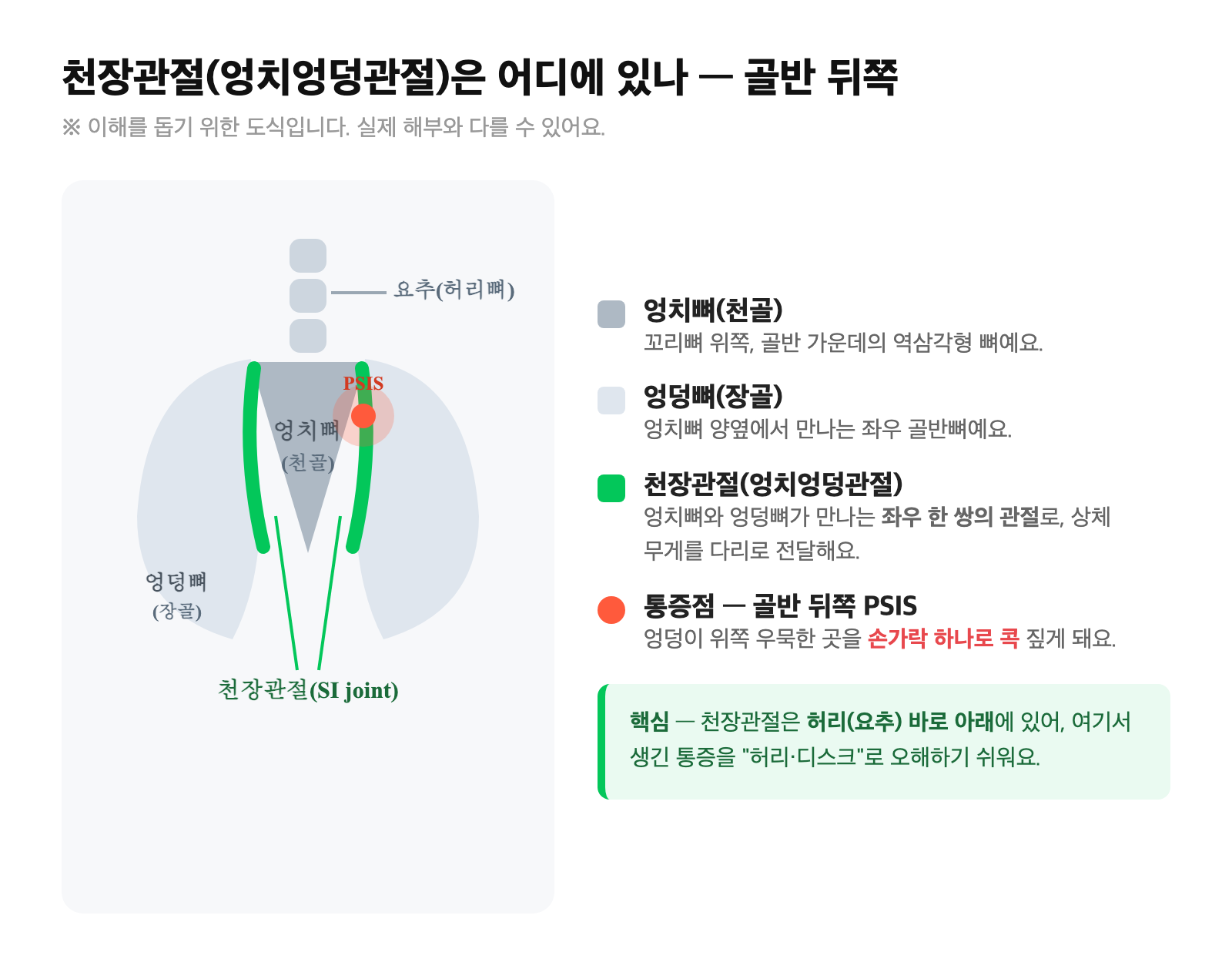 천장관절(엉치엉덩관절) 위치 도식 — 엉치뼈와 양쪽 엉덩뼈가 만나는 골반 뒤쪽 관절, PSIS 통증점과 요추와의 위치 관계