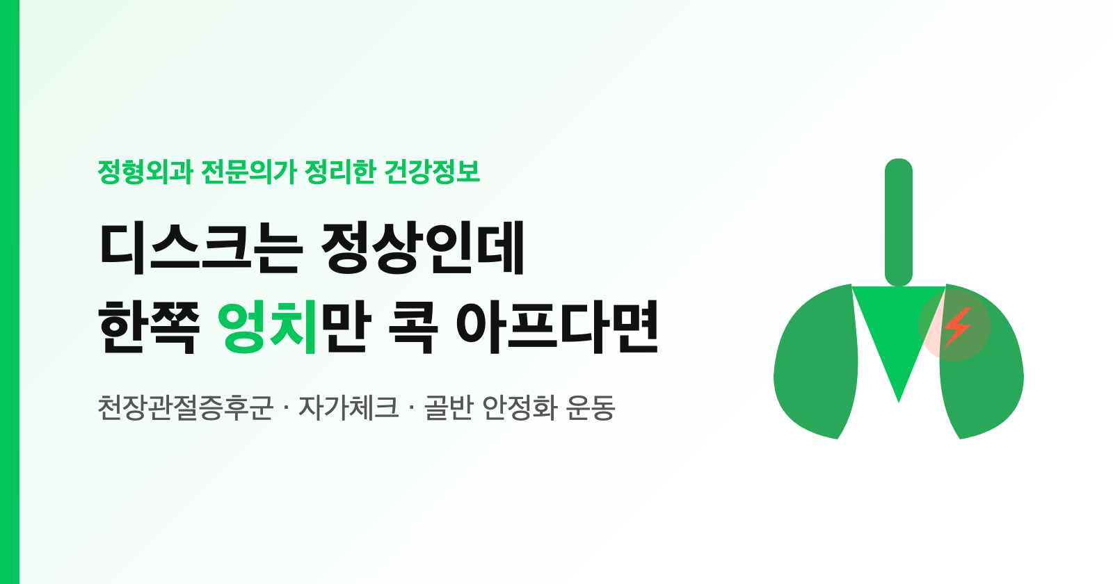디스크 검사는 정상인데 한쪽 엉치만 콕 아프다면? 천장관절증후군 자가체크·감별·운동 (허리디스크와 차이)