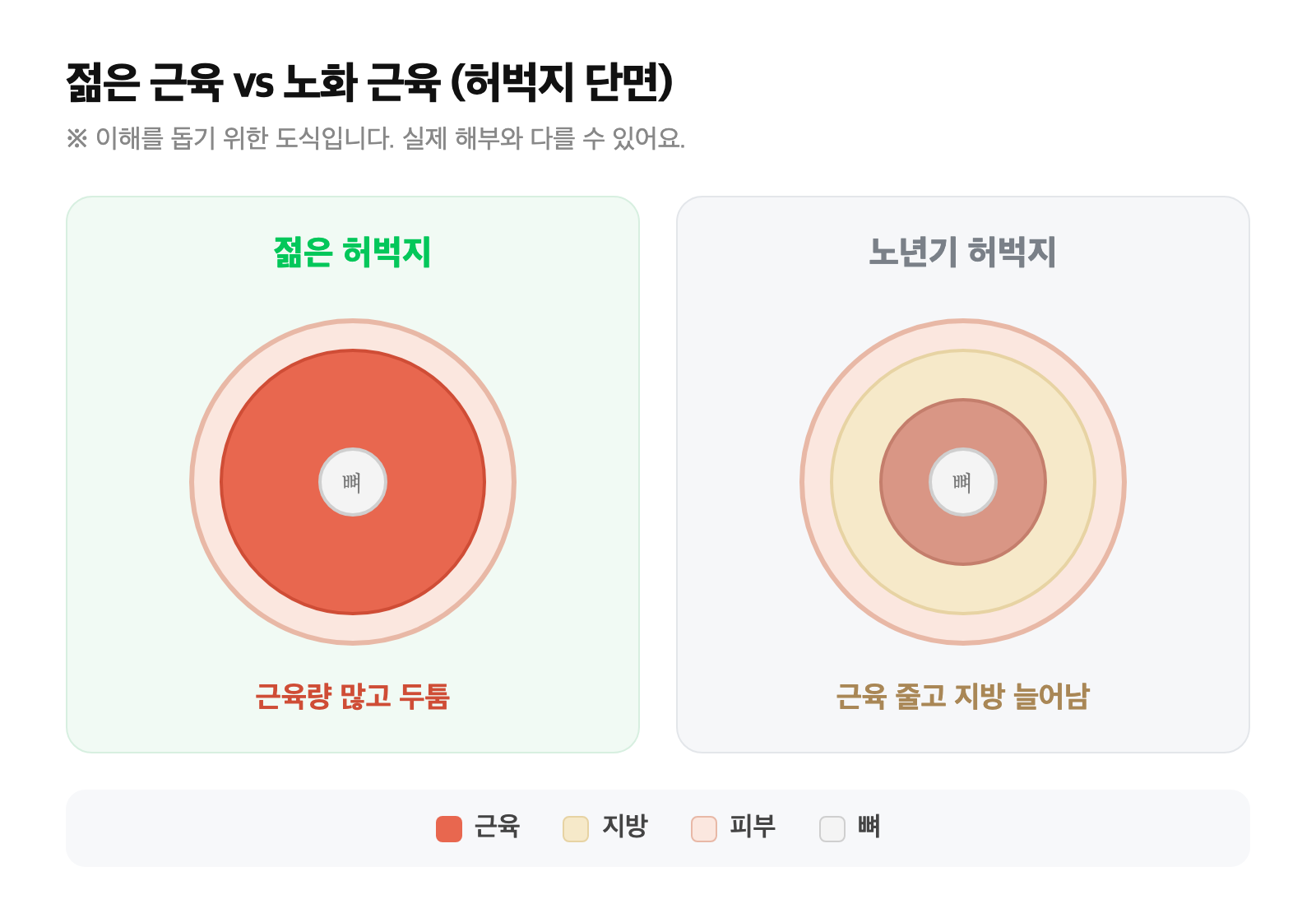 젊은 허벅지는 근육이 두툼하고, 노년기 허벅지는 근육이 줄고 지방이 늘어난 단면을 단순화해 비교한 도식