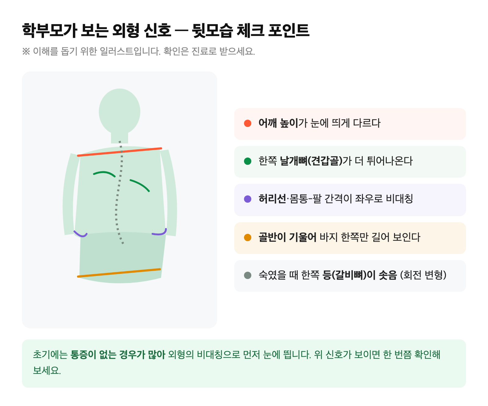 어깨 높이 차이·날개뼈 비대칭·허리선 비대칭·골반 기울기 등 외형 신호를 표시한 뒷모습 일러스트