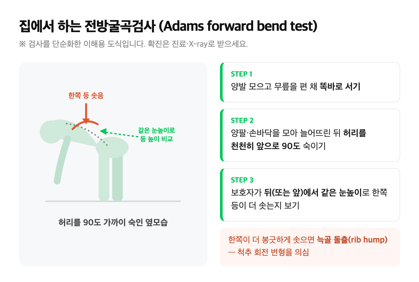 전방굴곡검사 자세와 한쪽 등이 솟아오른 늑골 돌출을 보여주는 도식