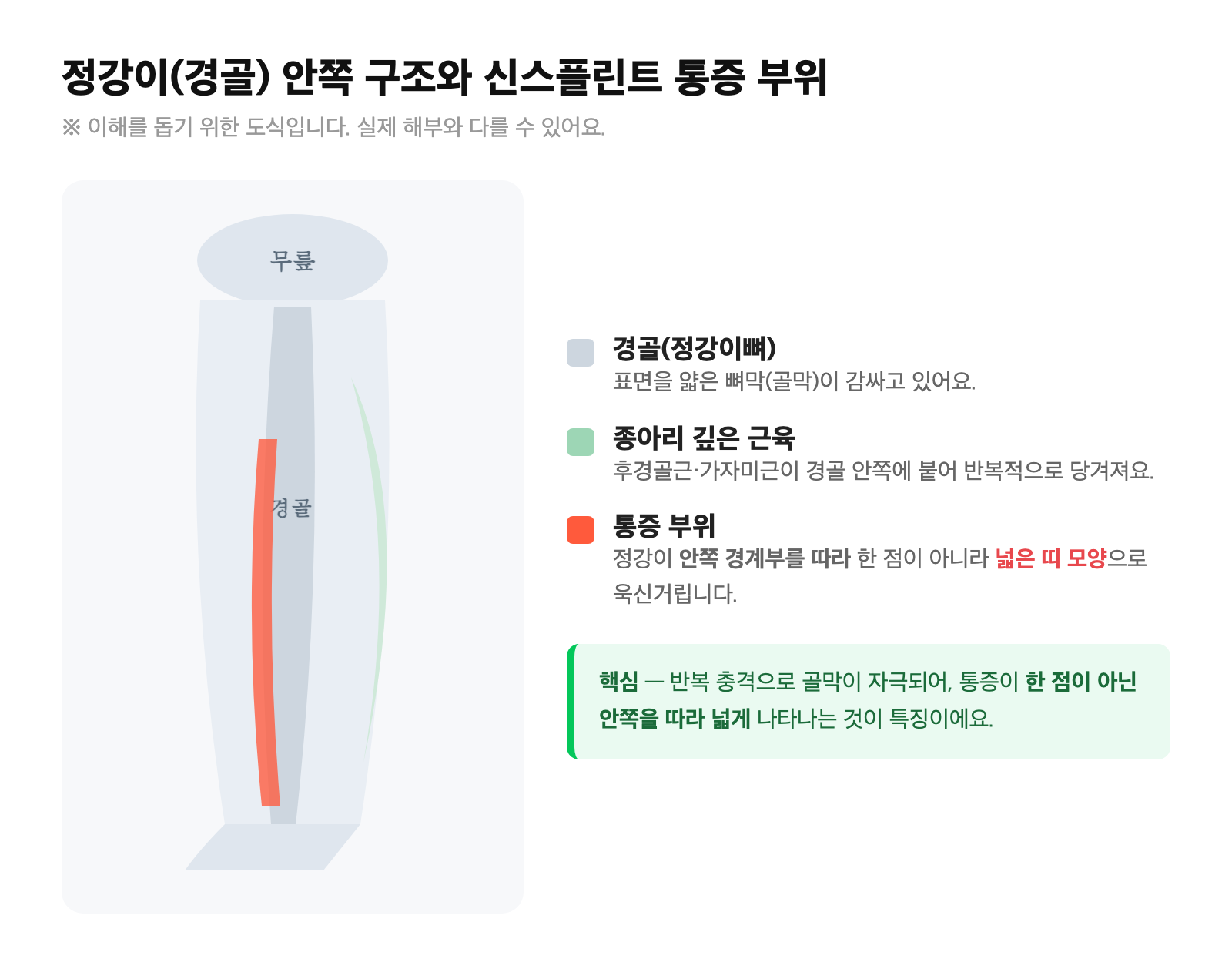 정강이(경골) 안쪽 경계부와 후경골근·가자미근 부착 부위, 안쪽을 따라 넓은 띠로 나타나는 신스플린트 통증 범위를 표시한 다리 도식