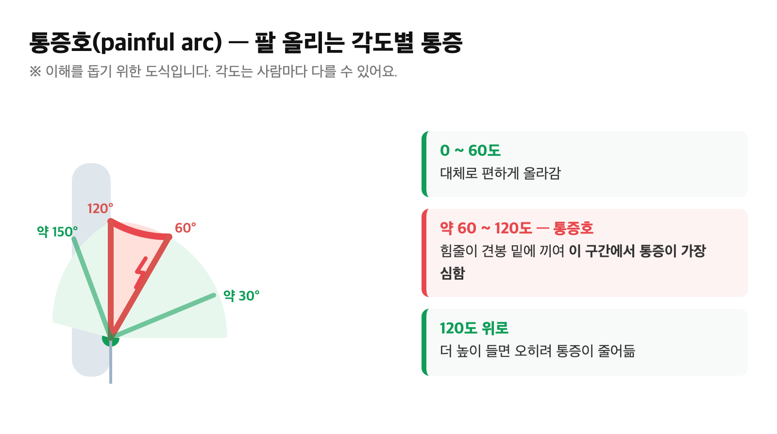 팔을 옆으로 들 때 약 60~120도 구간에서 통증이 가장 심하고 그 위로는 통증이 줄어드는 통증호를 표현한 모식도
