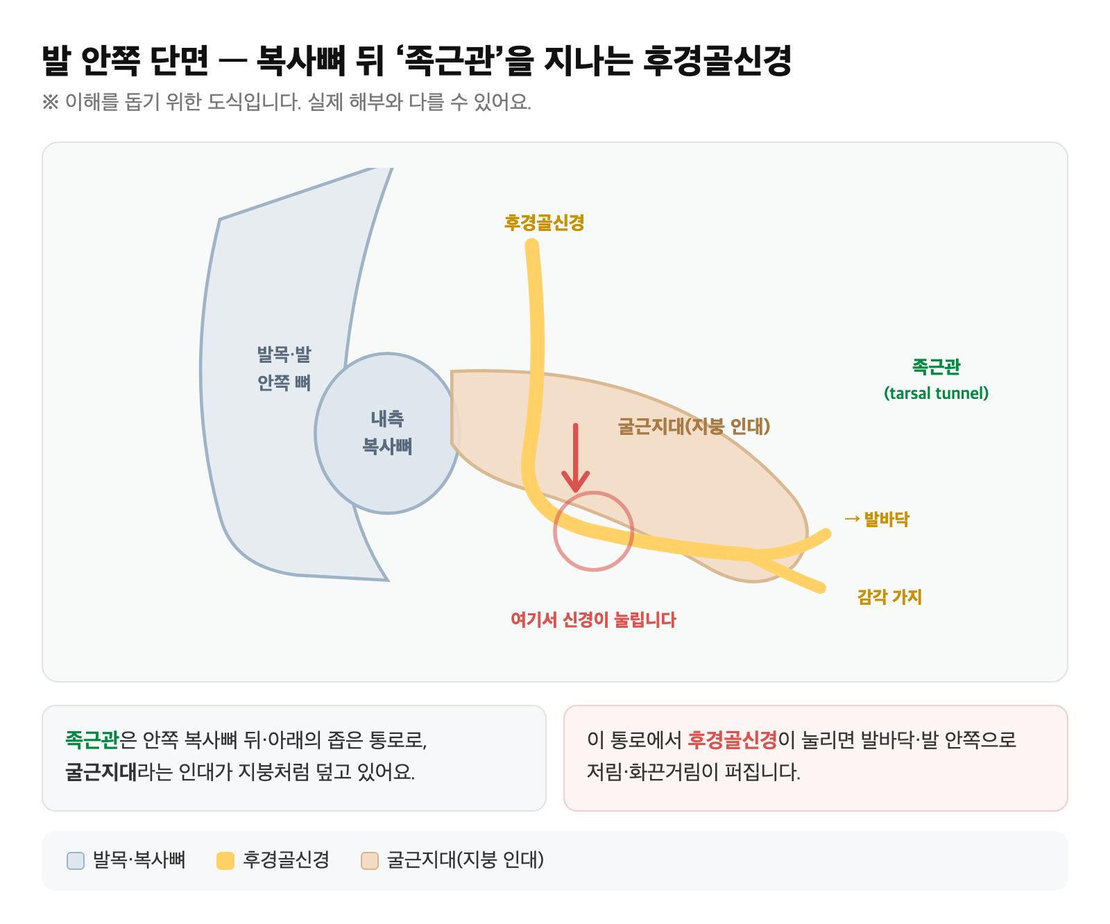 내측 복사뼈 뒤 족근관과 후경골신경이 지나가는 위치를 보여주는 해부 도식