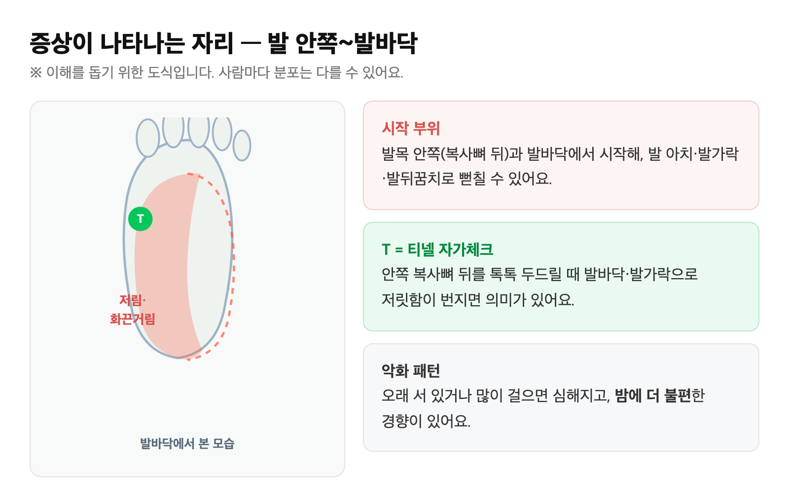 발바닥 저림·화끈거림이 나타나는 위치(발 안쪽~발바닥)를 표시한 그림