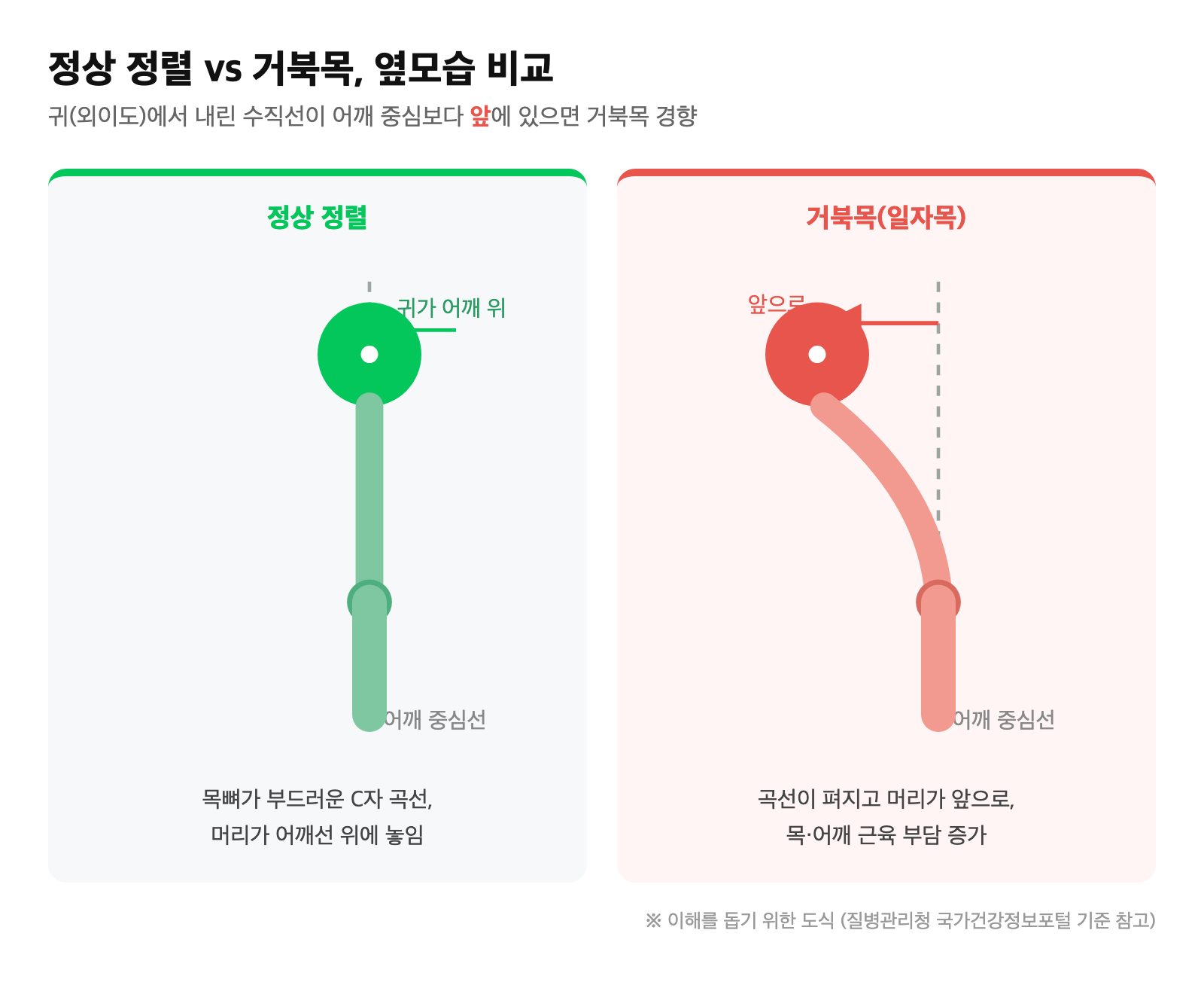 정상 정렬과 거북목(머리가 앞으로 나온) 옆모습 비교 도식