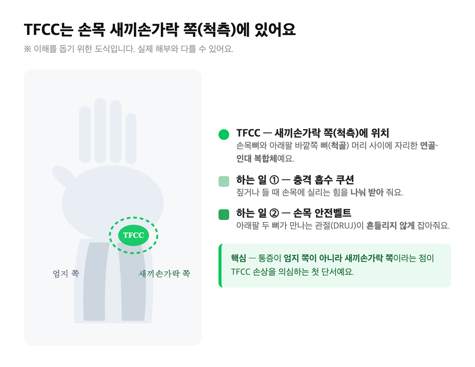 손목 새끼손가락 쪽(척측)에 위치한 TFCC의 대략적 위치를 보여주는 손목 부위 안내 그림 — 엄지 쪽과 새끼손가락 쪽을 구분