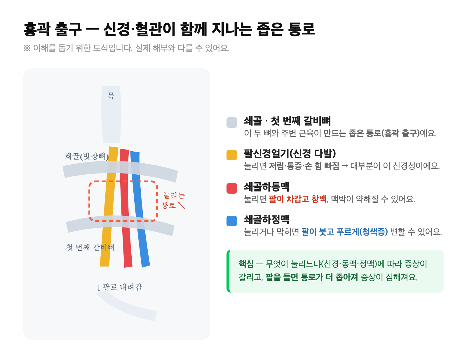 흉곽 출구 해부도 — 쇄골(빗장뼈)과 첫 번째 갈비뼈 사이로 팔신경얼기·쇄골하동맥·쇄골하정맥이 함께 지나가는 좁은 통로를 표시한 도식