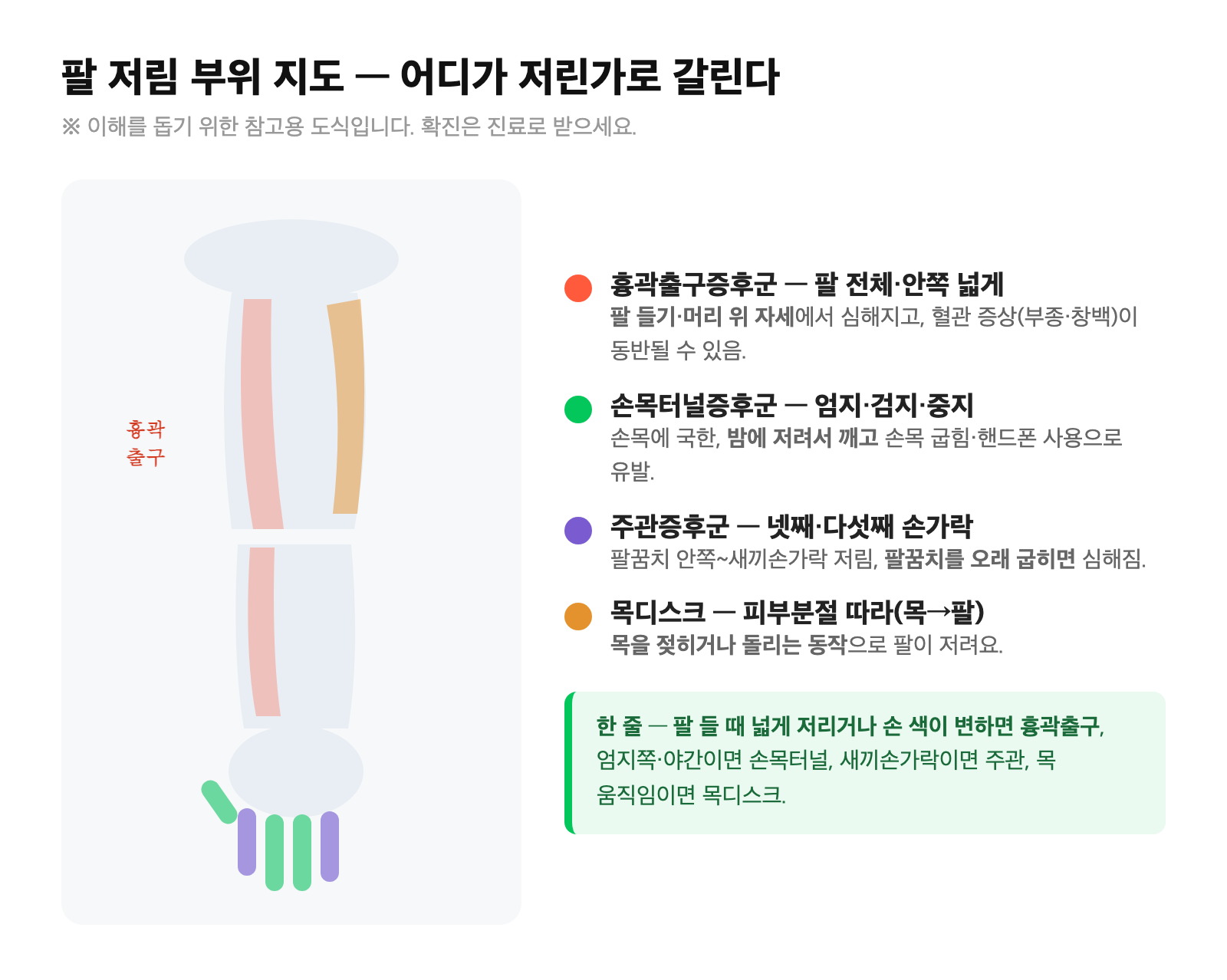 팔 저림 부위 지도 — 흉곽출구(팔 전체·안쪽) vs 손목터널(엄지·검지·중지) vs 주관(넷째·다섯째 손가락) vs 목디스크(분절)를 팔 그림 위에 비교 표시한 도식