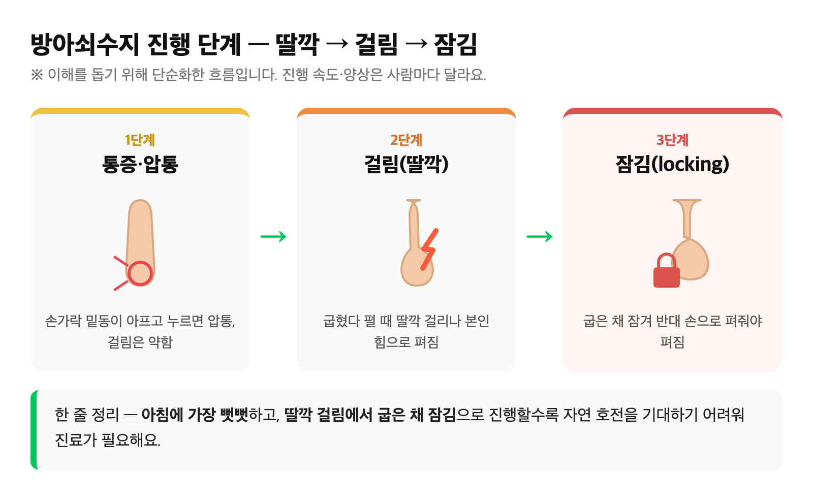 방아쇠수지가 딸깍·통증에서 걸림을 거쳐 굽은 채 잠기는 단계로 진행하는 과정을 단순화한 도식