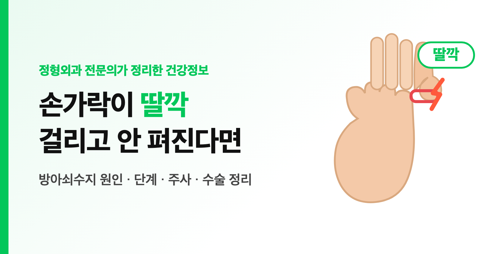 방아쇠수지 증상, 손가락 딸깍 걸리고 아침에 안 펴진다면? 원인·주사·수술 정리 (전문의)